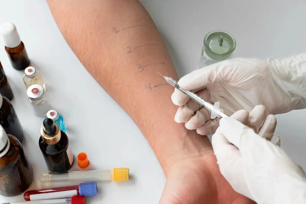 Laboratory technician analyzing a blood sample for allergy testing