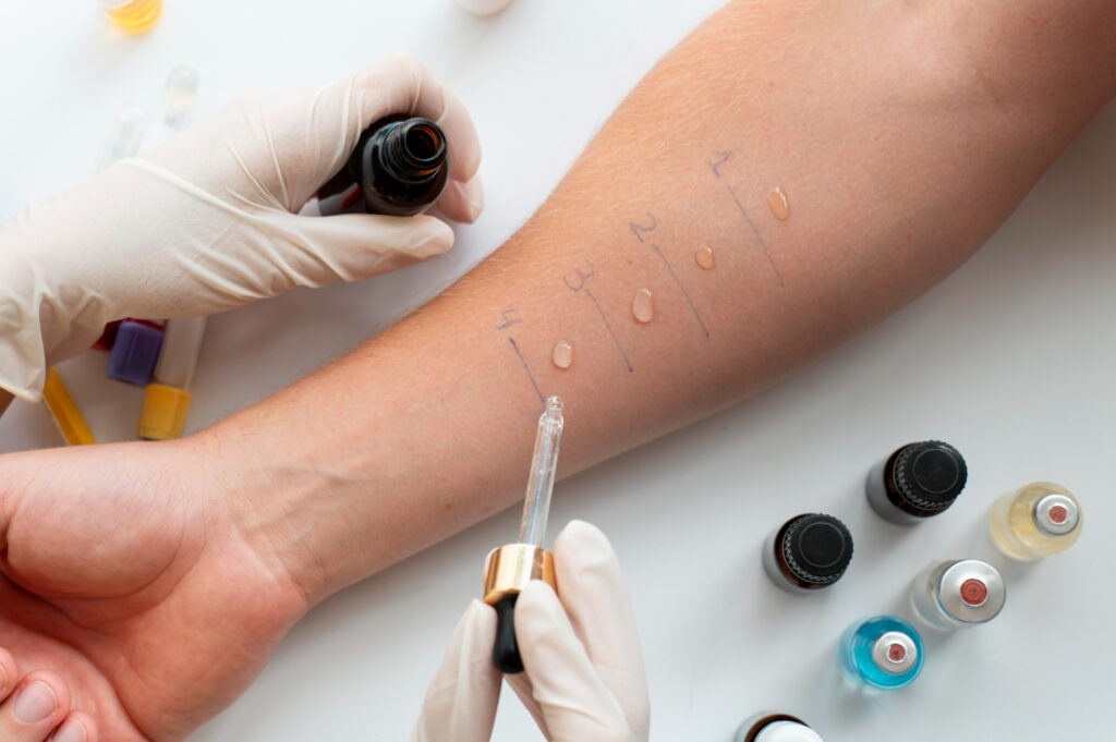 Allergy Testing